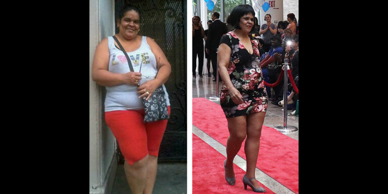 Bariatric Program Celebrates 10 Years