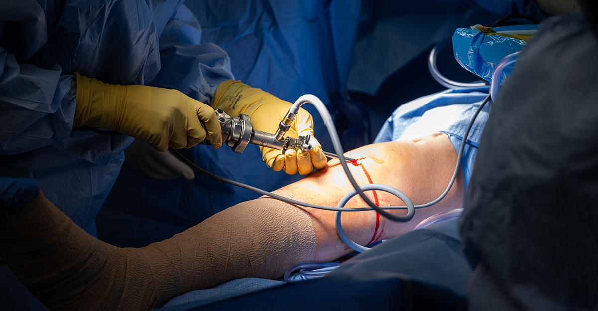 One very important piece of equipment used in arthroscopic surgery is the shaver, built for tough jobs like cutting bone and dense connective tissue with power manual instruments can’t match.